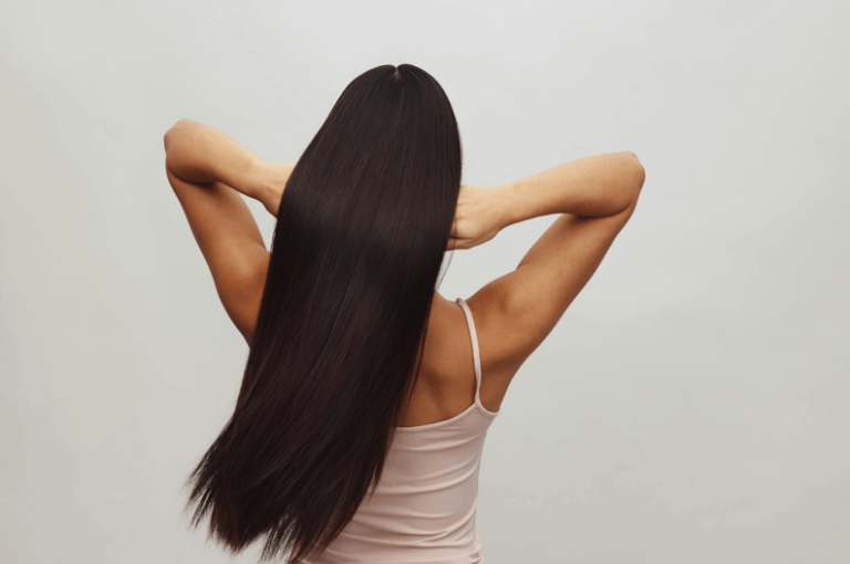 Best Hair Loss Treatment for Women